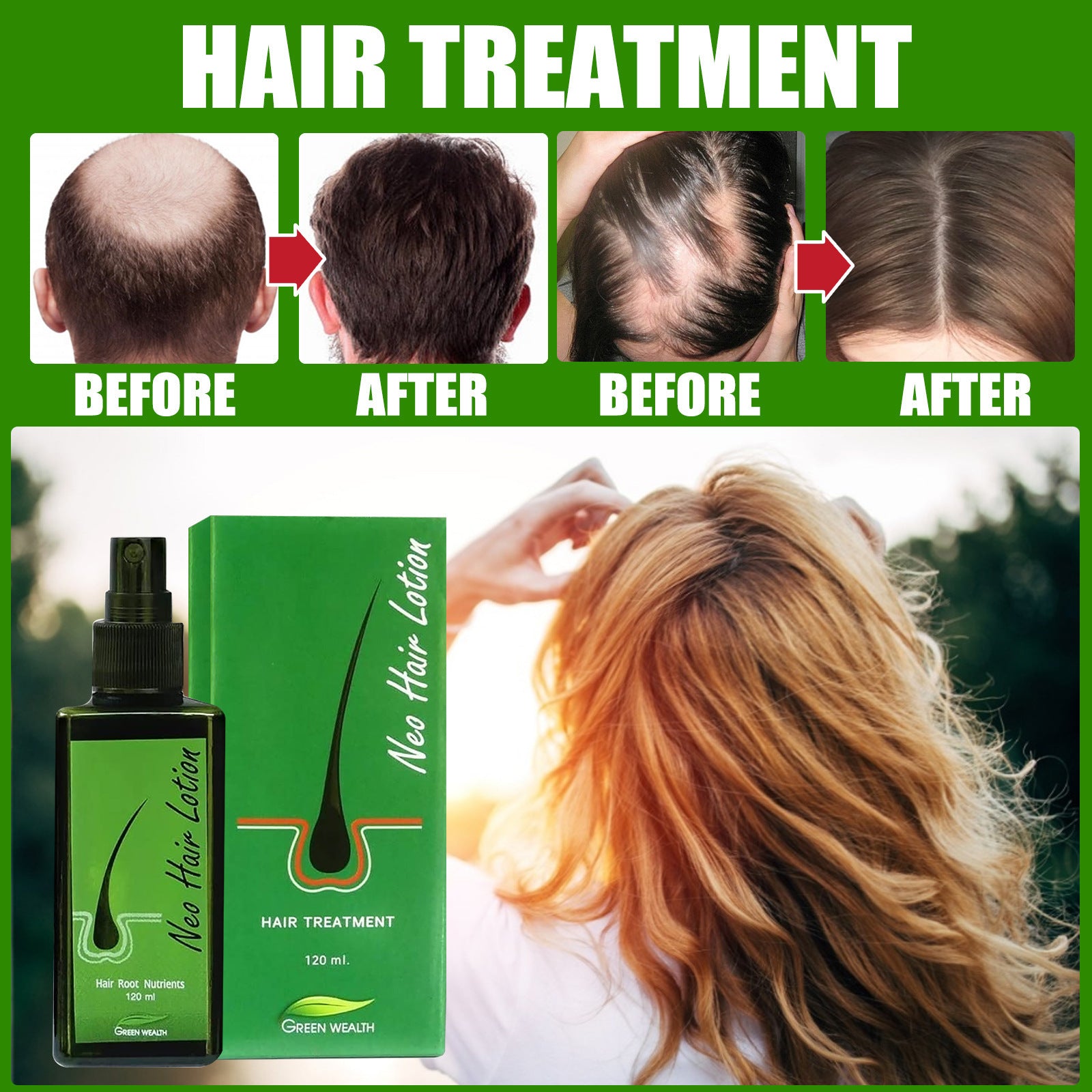 Hair Care Growth Lotion Spray Hair Care Growth Lotion Spray
